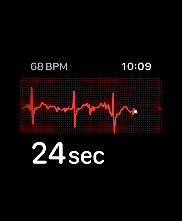 Ecg-app, aantal slagen per minuut rechtsboven, lijn die het ritme aangeeft, timer