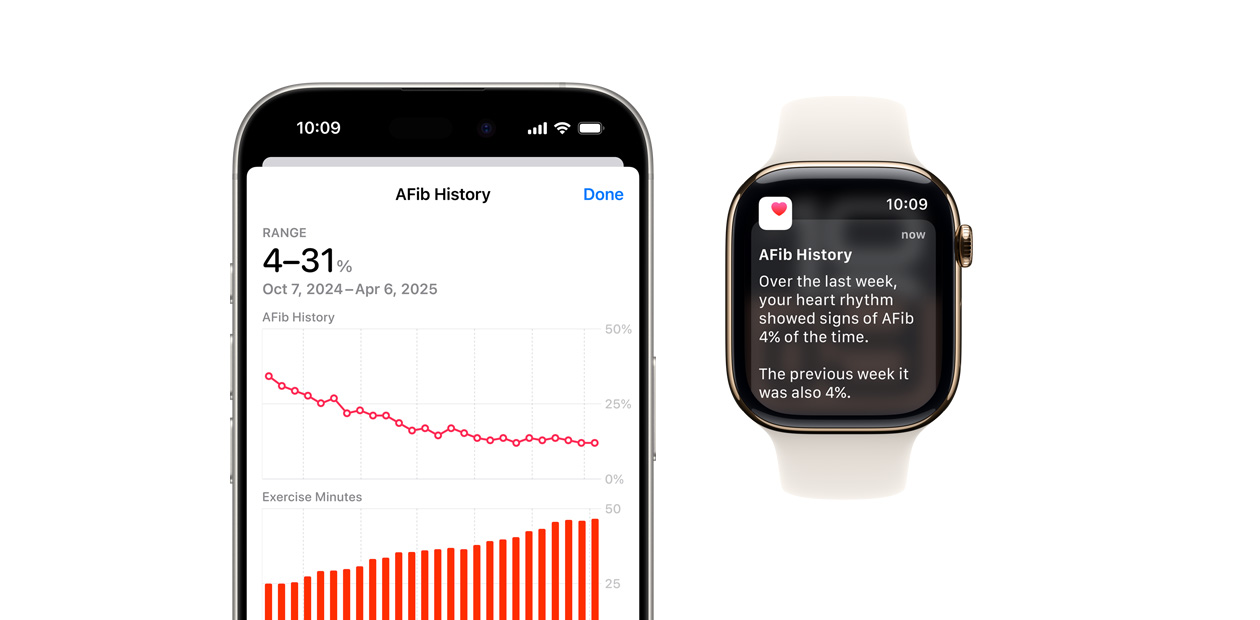 Software mostrando o app Histórico de Fibrila??o Atrial no iPhone e notifica??es no Apple Watch.